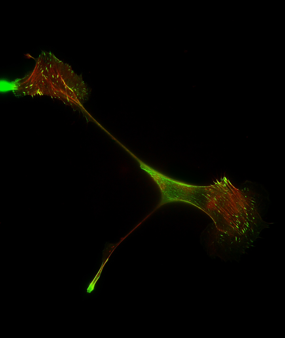 Image of Keratocyte Under Confocal Microscopy